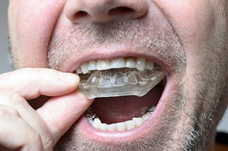 A man wearing a mouthguard