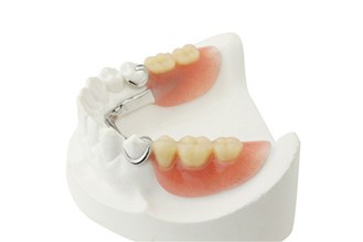 partial denture with metal clasp on a model 