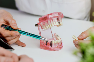 Dentist pointing to model of dental implant
