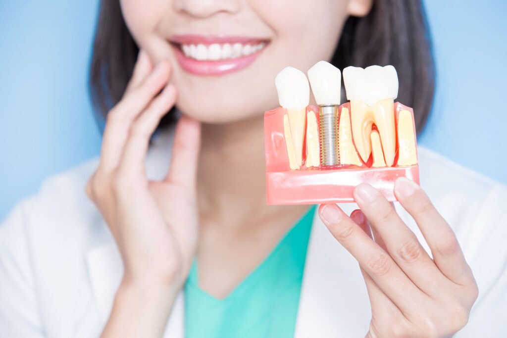 Nose-down view of dentist holding sample implant and touching her jaw