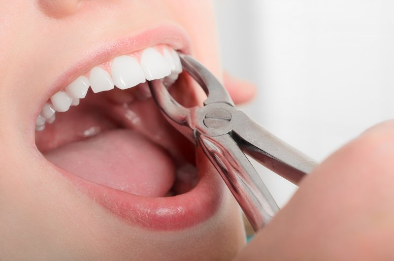 A dentist preparing to extract a patient’s tooth